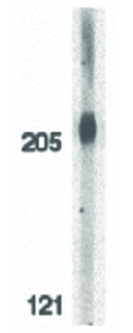 ACINUS Antibody in Western Blot (WB)
