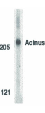 ACINUS Antibody in Western Blot (WB)