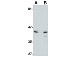 ACVR1 Polyclonal Antibody