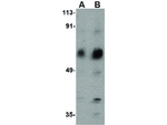 ACVR1C Polyclonal Antibody