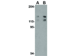 ADAP Antibody in Western Blot (WB)
