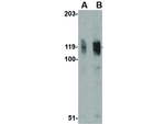 ADAP Antibody in Western Blot (WB)