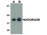 ADORA2B Polyclonal Antibody