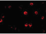 AES Antibody in Immunocytochemistry (ICC/IF)