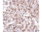 AFAP1L2 Antibody in Immunohistochemistry (Paraffin) (IHC (P))