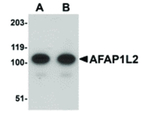 AFAP1L2 Antibody in Western Blot (WB)
