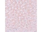 AFP Antibody in Immunohistochemistry (Paraffin) (IHC (P))