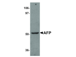 AFP Antibody in Western Blot (WB)