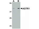 AGTR1 Antibody in Western Blot (WB)