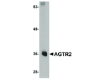 AGTR2 Antibody in Western Blot (WB)