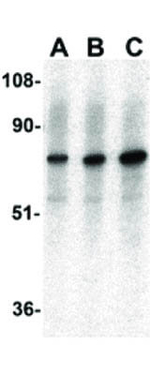 AIF Antibody in Western Blot (WB)