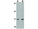 AIPL1 Antibody in Western Blot (WB)