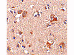 AIPL1 Antibody in Immunohistochemistry (Paraffin) (IHC (P))