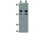 AIPL1 Antibody in Western Blot (WB)