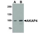 AKAP4 Antibody in Western Blot (WB)