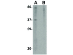 AKIRIN2 Polyclonal Antibody