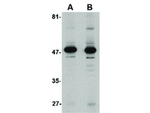 ALDH3A1 Polyclonal Antibody