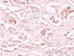 ALKBH2 Polyclonal Antibody