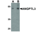 ANGPTL3 Antibody in Western Blot (WB)
