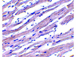 APAF1 Antibody in Immunohistochemistry (Paraffin) (IHC (P))