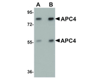 APC4 Antibody in Western Blot (WB)