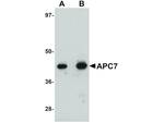 APC7 Antibody in Western Blot (WB)