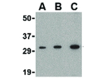 APH1 Polyclonal Antibody