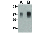 APH1 Antibody in Western Blot (WB)