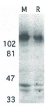 APP Antibody in Western Blot (WB)