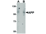 APP Antibody in Western Blot (WB)