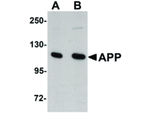 APP Antibody in Western Blot (WB)