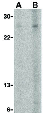 APRIL Polyclonal Antibody