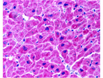 ARC Antibody in Immunohistochemistry (Paraffin) (IHC (P))