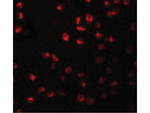 ARHGAP18 Antibody in Immunocytochemistry (ICC/IF)