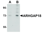 ARHGAP18 Antibody in Western Blot (WB)