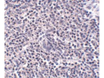 ARL15 Polyclonal Antibody