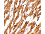 ASAH1 Antibody in Immunohistochemistry (Paraffin) (IHC (P))