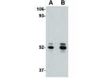 ASAH1 Antibody in Western Blot (WB)