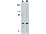ASAH2 Polyclonal Antibody