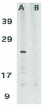 ASC Antibody in Western Blot (WB)