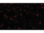 ASK1 Antibody in Immunocytochemistry (ICC/IF)