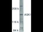 ASK1 Antibody in Western Blot (WB)