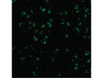 ASK1 Antibody in Immunocytochemistry (ICC/IF)