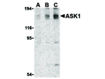 ASK1 Antibody in Western Blot (WB)