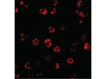 ATG16 Antibody in Immunocytochemistry (ICC/IF)