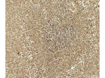 ATG4B Antibody in Immunohistochemistry (Paraffin) (IHC (P))