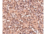 ATG5 Antibody in Immunohistochemistry (Paraffin) (IHC (P))
