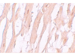 ATG9A Antibody in Immunohistochemistry (Paraffin) (IHC (P))