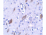 ATOH8 Polyclonal Antibody