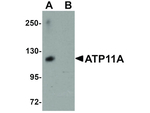 ATP11A Antibody in Western Blot (WB)